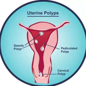 北京做试管婴儿要多少钱，怎么收费！